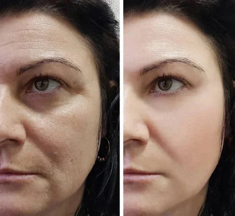 Magic Cream Face Lift